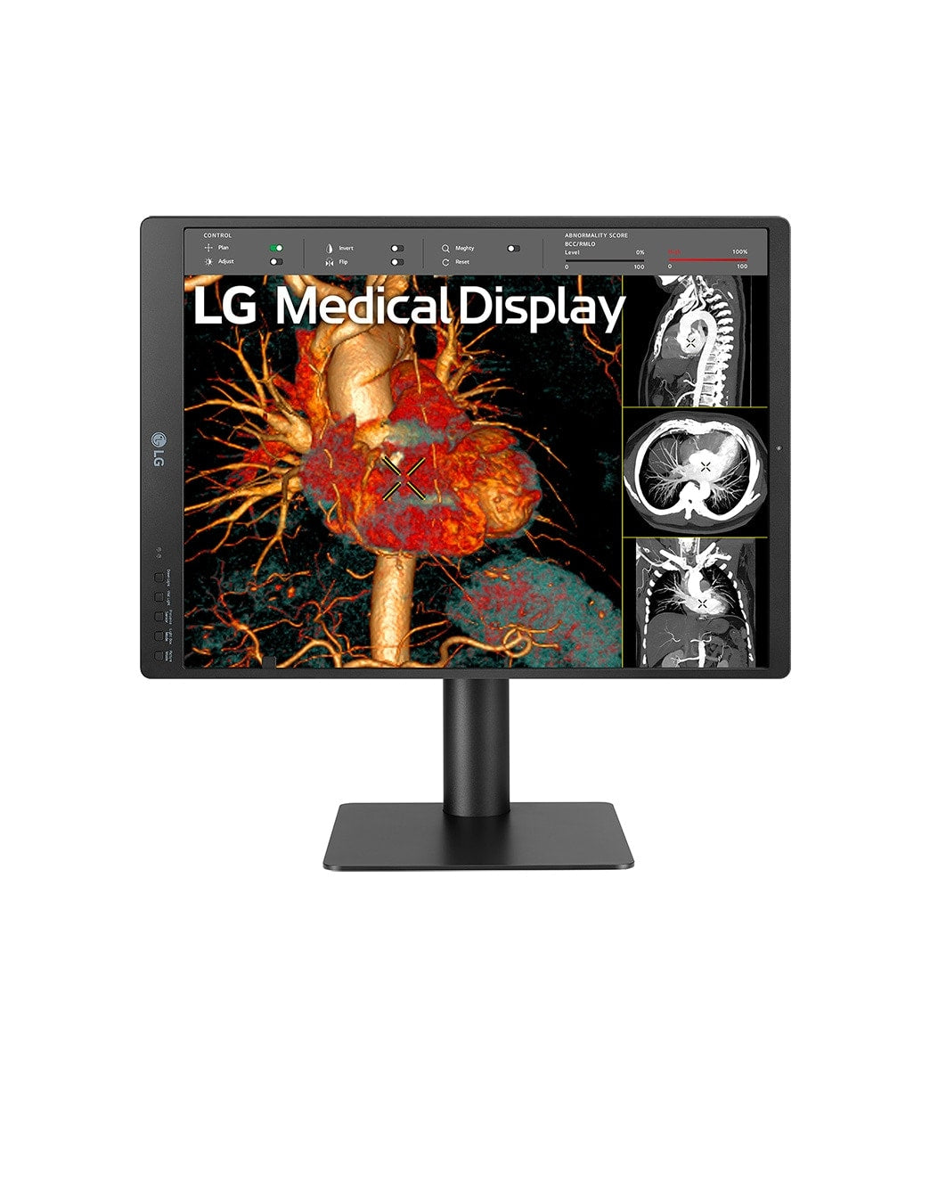 LG LG 21HQ513D-B/21'' Grayscale 3MP platta pc-skärmar 54,1 cm (21.3") 1536 x 2048 pixlar HD LCD Svart